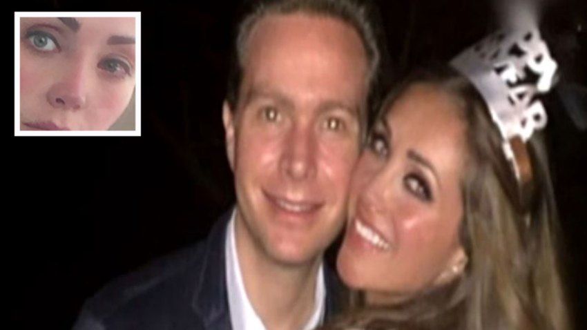 anahi-conjuntivitis