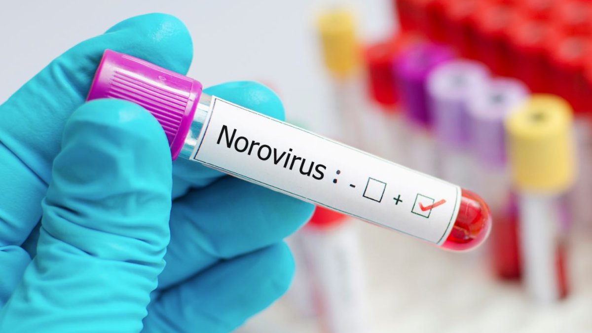What is norovirus and how is it spread – Telemundo San Antonio (60)
