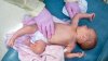 CDC: escasea medicina clave para bebés mientras aumentan casos de virus respiratorio