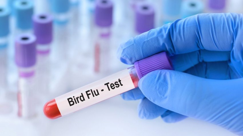 Doctor holding a test blood sample tube with Bird Flu test on the background of medical test tubes with analyzes.